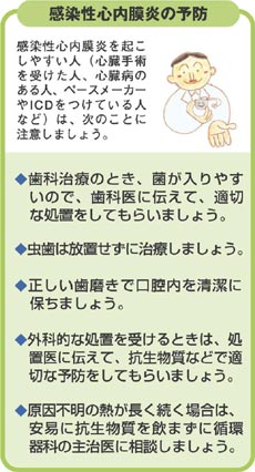 ガイドライン 内 膜 心 感染 性 炎