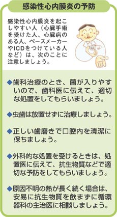 心 ガイドライン 性 感染 炎 内 膜