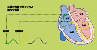 不整脈 ペースメーカー ハートニュース 心日本心臓財団刊行物 公益財団法人 日本心臓財団