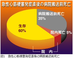 梗塞 率 心筋 死亡