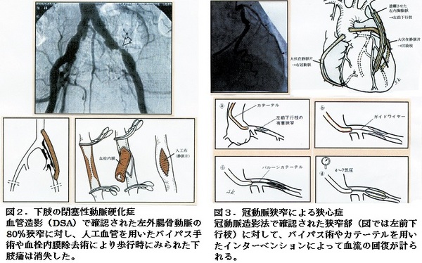 53図２と３.jpg