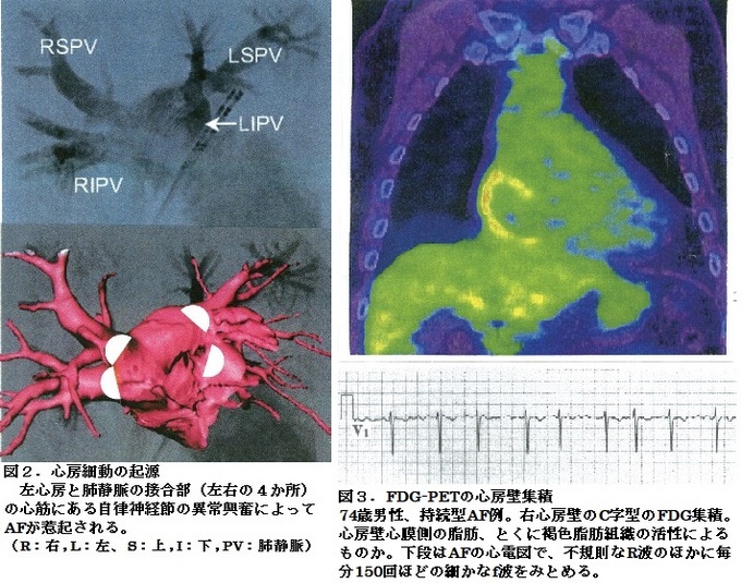 65図2と3.jpgのサムネイル画像