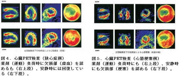 67図４と５.jpg