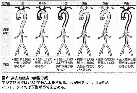 病型分類.jpg