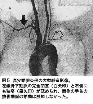 造影写真.jpg