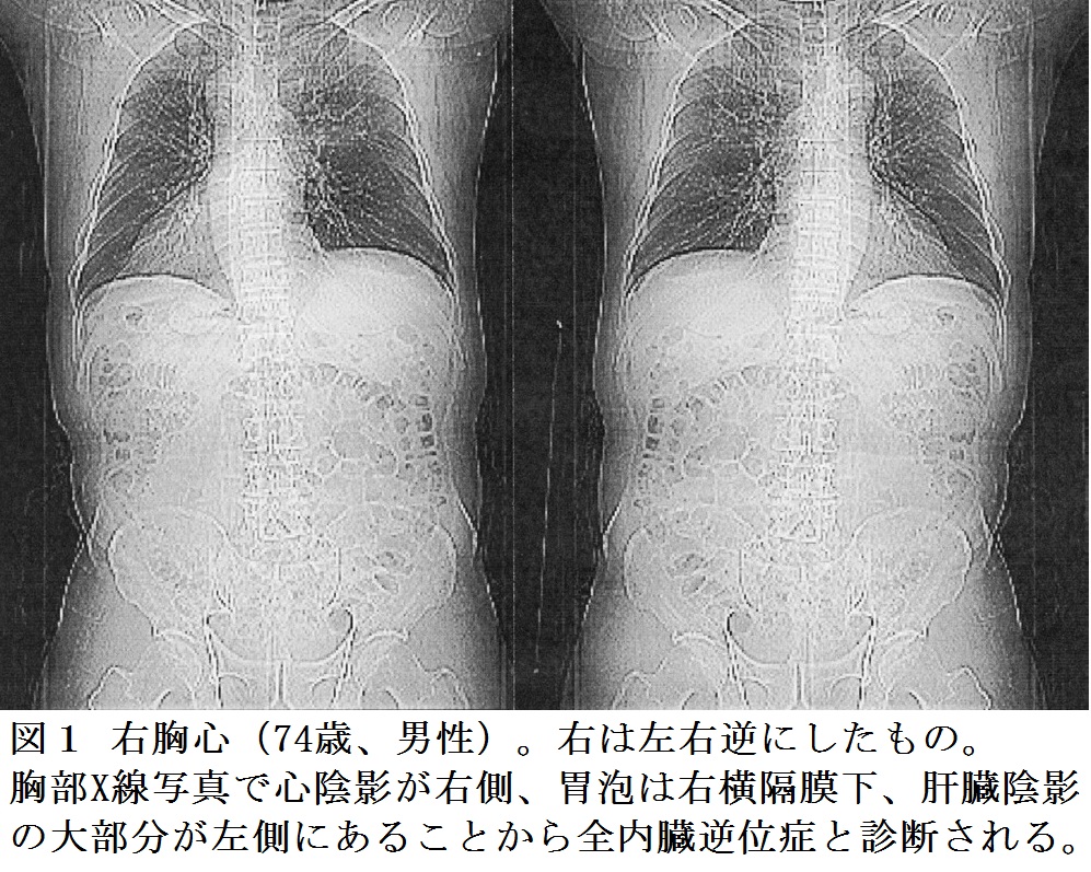 耳寄りな心臓の話（第27話）『心臓はどうして左に』 ｜はあと文庫｜心