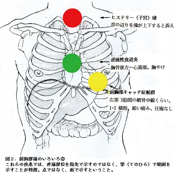 痛い 肋骨 真ん中 「胸の真ん中が痛い」胸肋関節の痛み。その原因と対策｜府中オステオパシーまるちゃん整体院