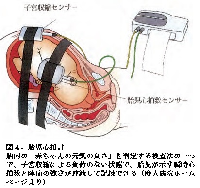胎児心拍計 楽天市場】胎児超音波心音計【超音波ジェル付き】 スピーカー