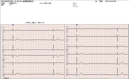 124洞不全症候群.JPG