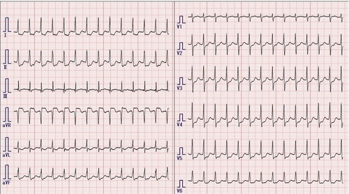 171AVNRT180bpm.jpg