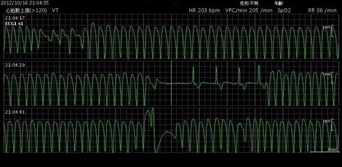 83VT.jpg