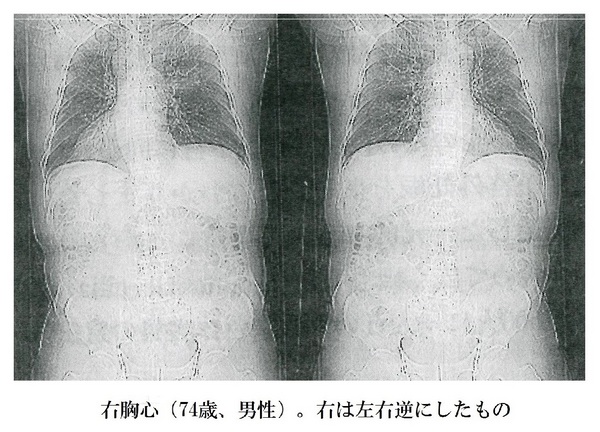 9右胸心.jpg