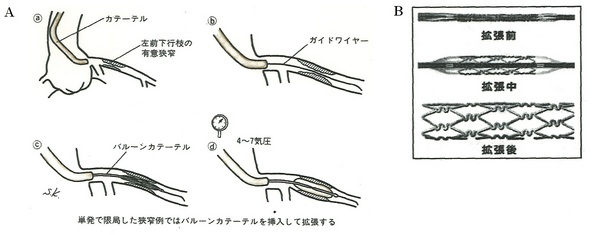 147ＰＴＣＡ.jpg