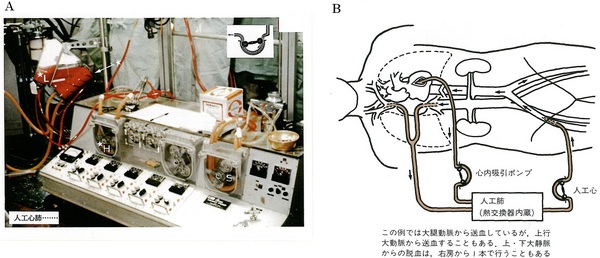 77人工心肺Ｂ赤(図Ｒ-2）.jpg
