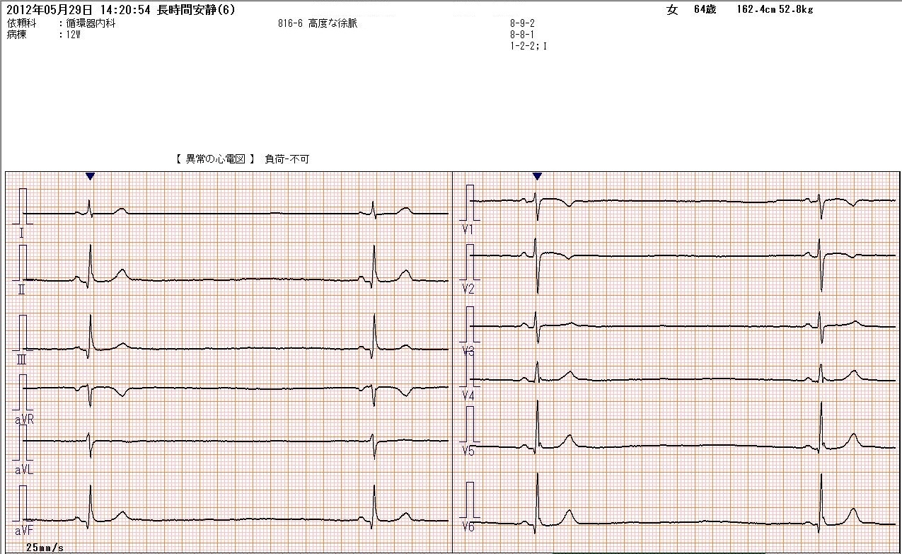 洞不全症候群 | 心臓病用語集 | 心臓病の知識 | 公益財団法人 日本心臓財団