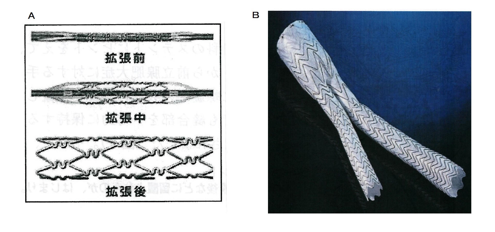 ステント | 心臓病用語集 | 心臓病の知識 | 公益財団法人 日本心臓財団