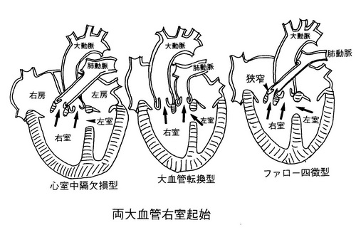 186両大血管右室起始.jpg