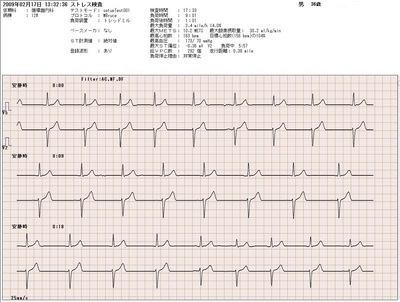 22カテコラミン01TMT負荷前.jpg