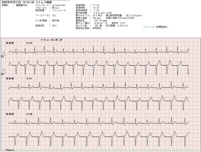22カテコラミン03TMT負荷後.jpg