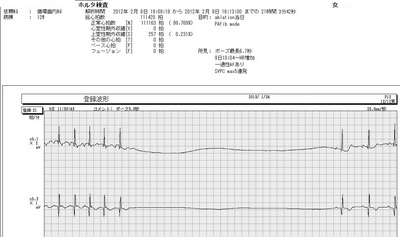 72徐脈頻脈症候群.jpg