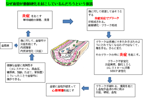 歯周病なぜ血管が2.png