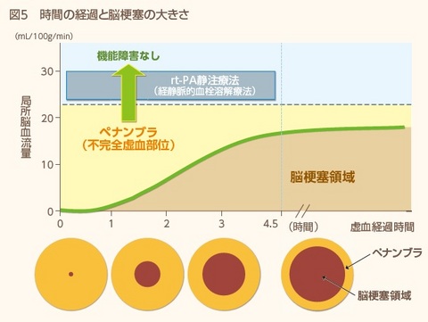 脳卒中図５.jpg