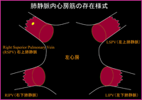 \1