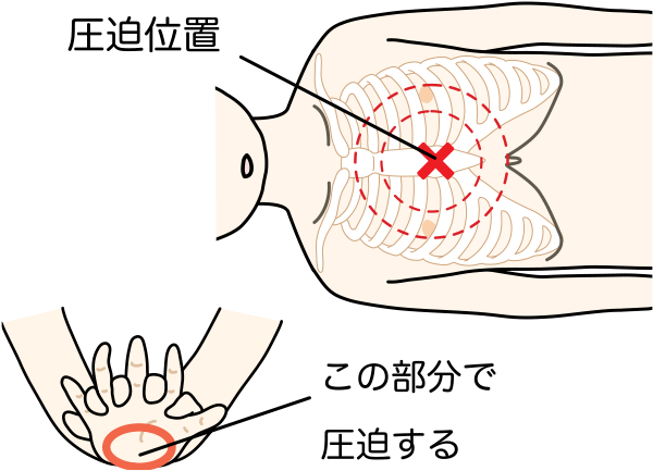 やり方 心臓 マッサージ