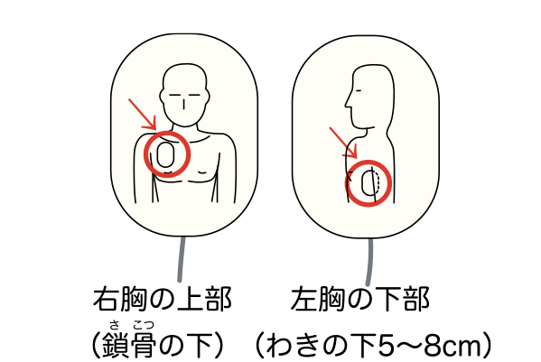 Aedを使った救命の仕方 Aedで助かる命 心臓病の知識 公益法人 日本心臓財団