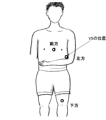 図１