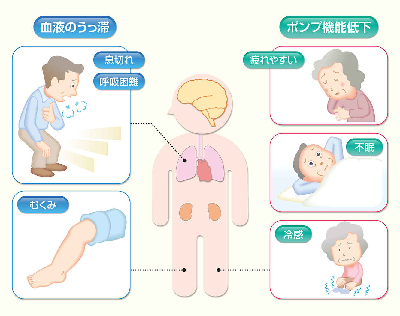 図4：心不全の症状