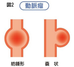 動脈図2-thumb-300x272-2130.jpg