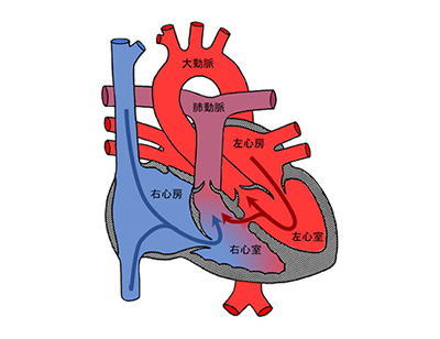 先天性心疾患の数と種類