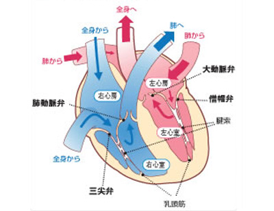 先天性弁膜症