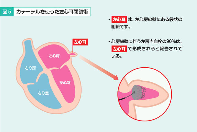 図5.jpg