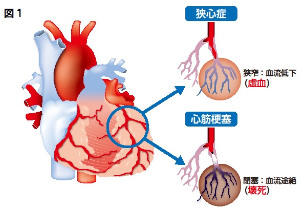 樗木図１.jpg