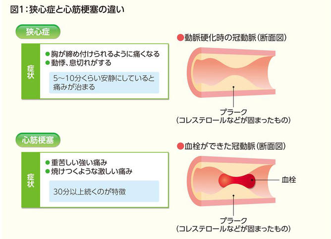 血 の 疑い 心筋 虚