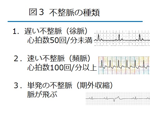 不整脈 自由が丘内科循環器科クリニック｜不整脈｜めまい 立ちくらみ